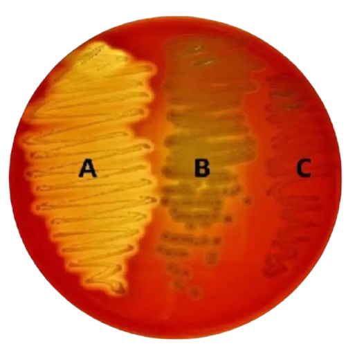 sheep blood agar